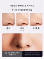 시각적 블랙헤드 흡입기, 가정용 여드름 제거, 작은 거품 흡입기, 얼굴 모공 청소, 뷰티 살롱 기구 - 이미지 3