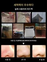 초음파 블랙헤드 삽 뷰티 살롱 블랙헤드 리무버 스킨 딥 클렌징 삽 스킨 스크레이퍼 스킨 스크레이퍼 뷰티 기구 - 이미지 4