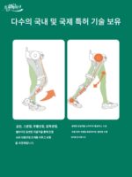 기계식 외골격 보조 보행 장치 반신마비 보행 착용형 외골격 보조 다리 하지 부스터 - 이미지 4