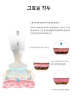 한국 플라즈마 오존 여드름 재생 수리 항염 살균 클렌징 피부 미용 기구 뷰티 살롱 - 이미지 4
