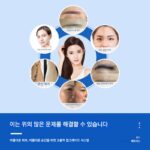 피코 눈썹 제거기 비침습적 블랙 테크놀로지 타투 제거기 뷰티 살롱 전용 다기능 피코초 주근깨 제거 기구 - 이미지 4