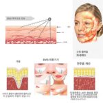 EMS 저주파 펄스 얼굴 마사지기 리프팅 및 퍼밍 뷰티 기기 V자형 얼굴 안면 근육 자극기 눈 뷰티 기기 - 이미지 3