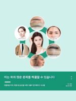 피코 비침습 브릴리언트 눈썹 리무버 고출력 블랙 테크놀로지 다기능 휴대용 소형 피코초 주근깨 제거 기구 - 이미지 3