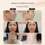 [V페이스 슬리밍 아티팩트] 페이스리프팅 및 퍼밍 롤러 뷰티 기구 얼굴 슬리밍 턱살 혹근육 가정용 - 이미지 4